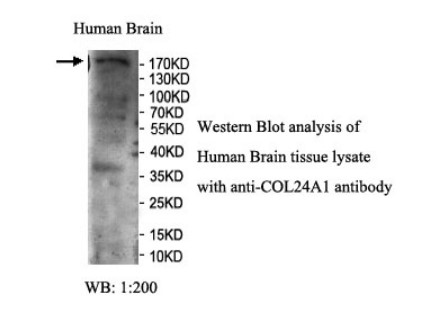 COL24A1 Rabbit Polyclonal Antibody