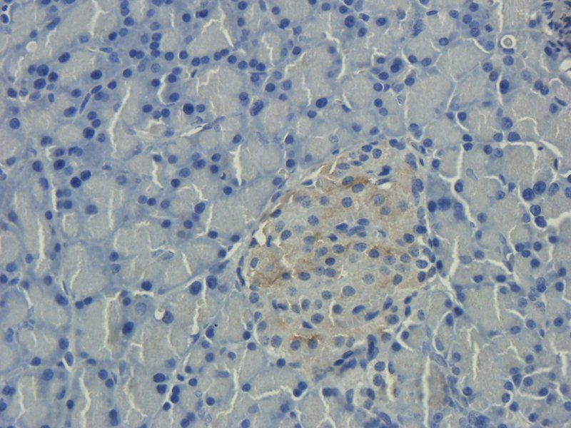 Collagen IV antibody