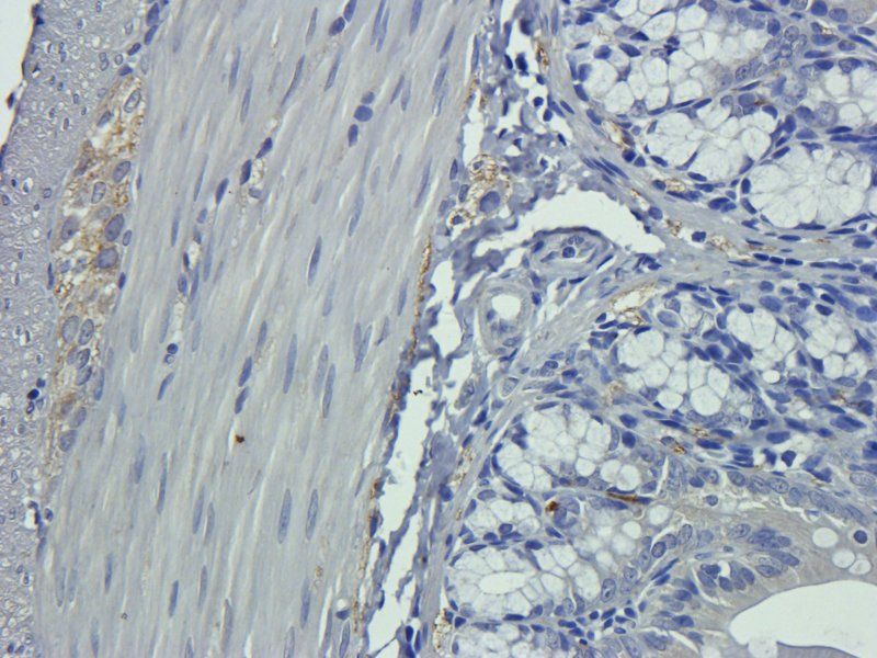 Collagen IV antibody