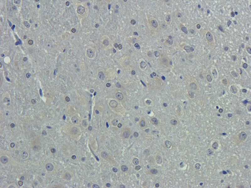 Collagen IV antibody