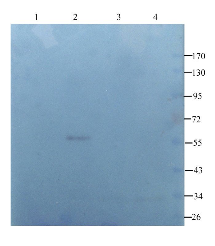 Collagen IV antibody