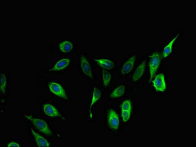 COL4A3BP Antibody