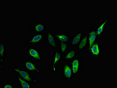 COL4A3BP antibody