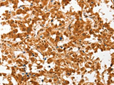 COL4A3BP Antibody