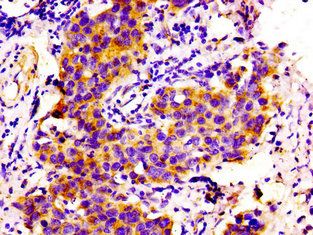 COL6A2 Antibody