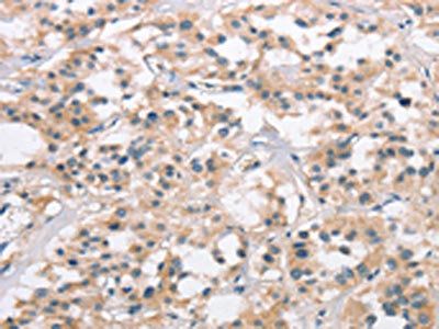 COL7A1 Antibody