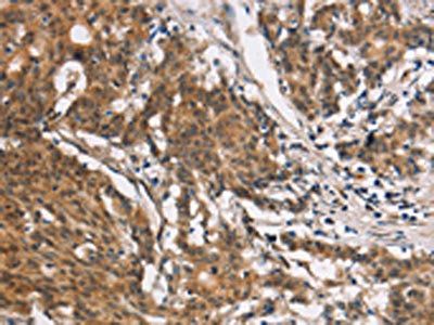 COL7A1 Antibody