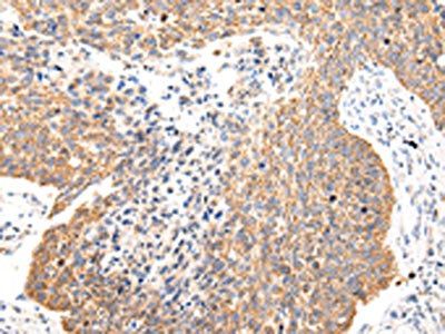 COL8A2 Antibody
