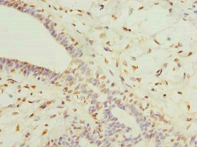 COLGALT2 Antibody