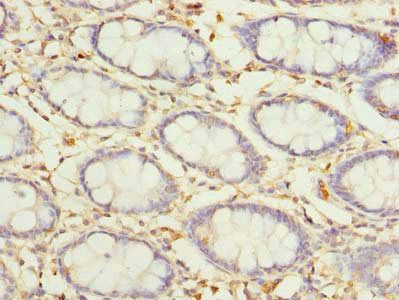 COLGALT2 Antibody