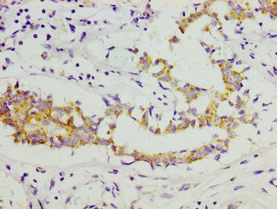 Collagen alpha-1(XI) chain antibody