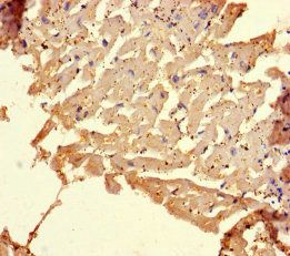 COL11A1 Antibody