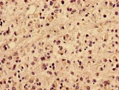 COL4A1 Antibody
