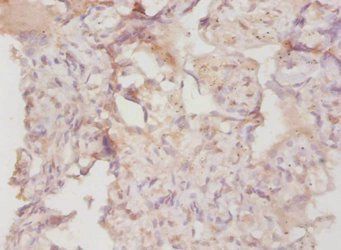 COL4A3 Antibody