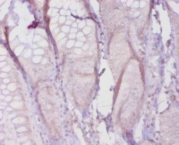 Col1a1 Antibody