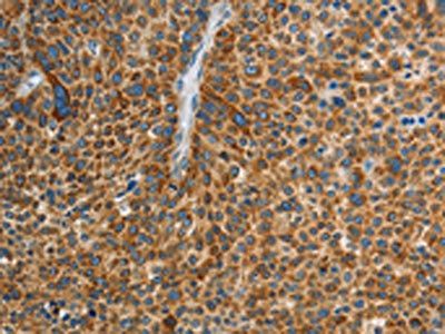 COL1A2 Antibody