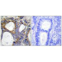 Collagen I antibody