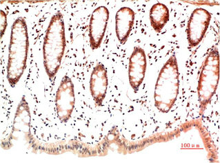 COL1A1 Monoclonal Antibody