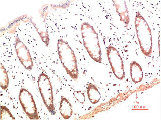 COL1A1 Monoclonal Antibody