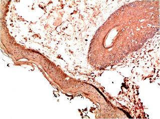 COL1A1 Monoclonal Antibody