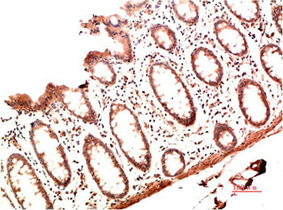 COL1A1 Monoclonal Antibody