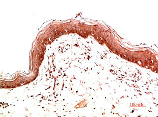 COL1A1 Monoclonal Antibody