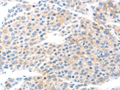 COL2A1 Antibody