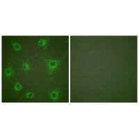 Collagen II antibody