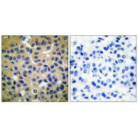 Collagen II antibody