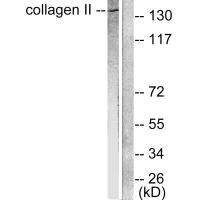 Collagen II antibody