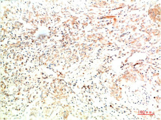 COL2A1 Monoclonal Antibody