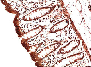COL2A1 Monoclonal Antibody
