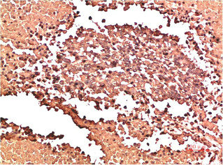 Collagen II antibody