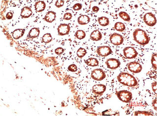 COL2A1 Monoclonal Antibody
