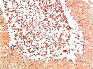 COL2A1 Monoclonal Antibody