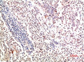 COL2A1 Monoclonal Antibody