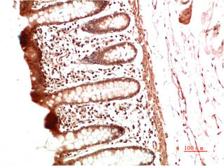 COL2A1 Monoclonal Antibody