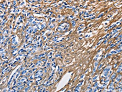 COL3A1 Antibody
