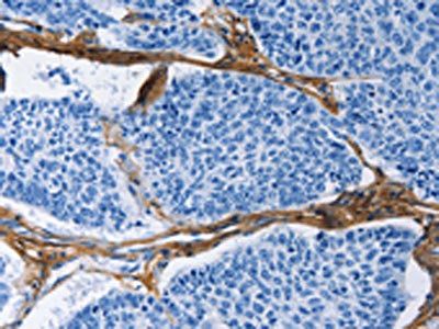 COL3A1 Antibody