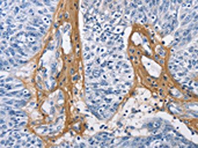 Collagen III antibody