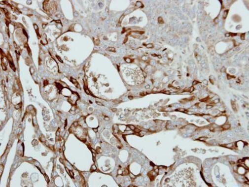 Collagen III antibody [C2C3-2], C-term