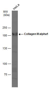 Collagen III antibody