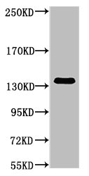 COL3A1 Monoclonal Antibody