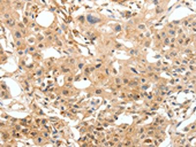 COL4A1 Antibody
