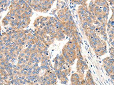 COL4A1 Antibody