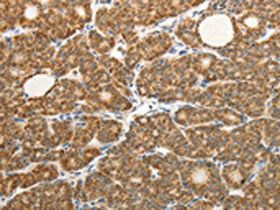 COL4A3 Antibody