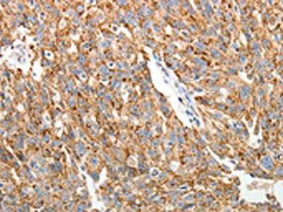 COL4A3 Antibody