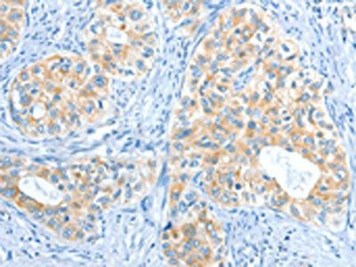 COL4A2 Antibody