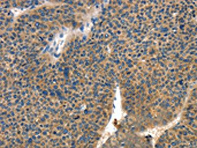 Collagen IV antibody