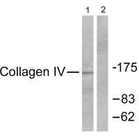 COL4A1 Antibody